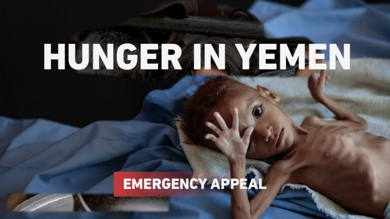 Hunger in Yemen emergency appeal: a malnourished child lying on a blanket