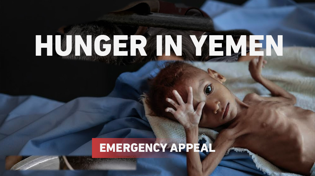 Yemen Emergency Appeal 3 Hunger in Yemen